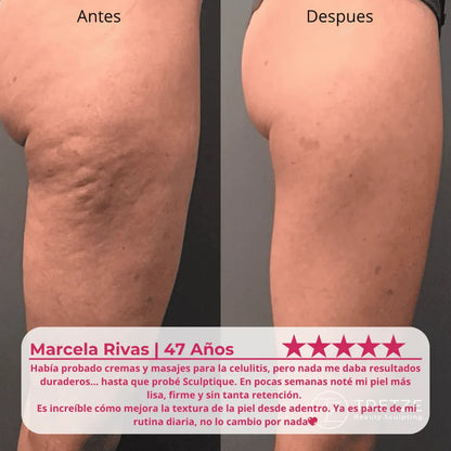 Cápsulas antilipidema de máxima potencia | Piel suave con Sculptique™